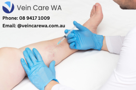 Vein Care WA